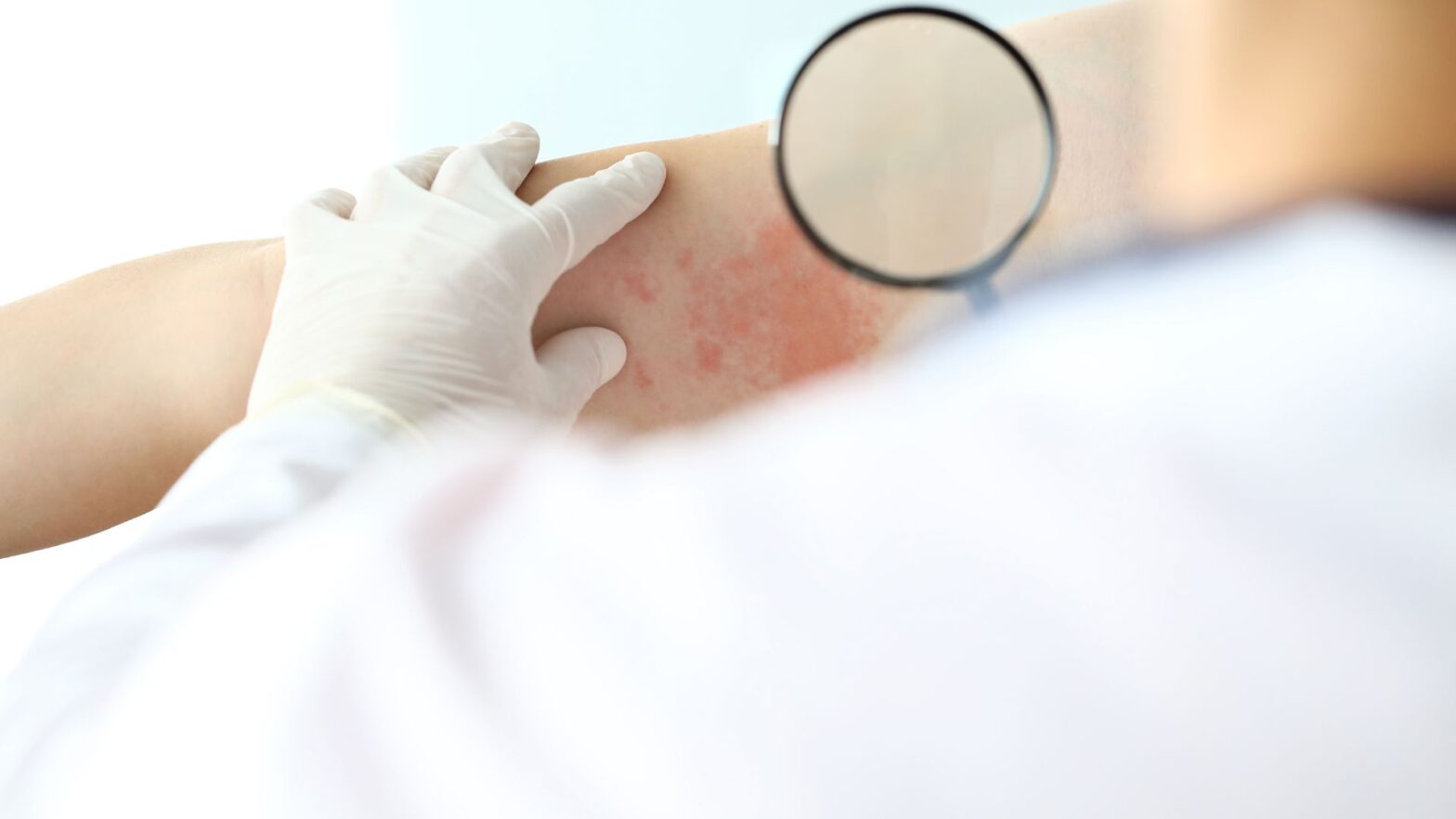 Quanto custa uma consulta com dermatologista