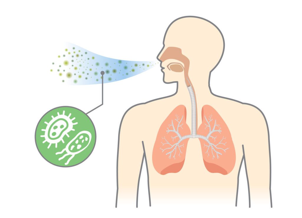 Causas da pneumonia